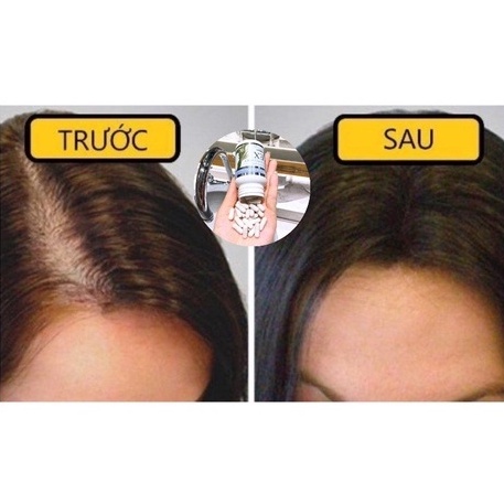 Viên Uống Ngăn Ngừa Rụng Tóc Nhật Bản Best Biotin Supplement EX