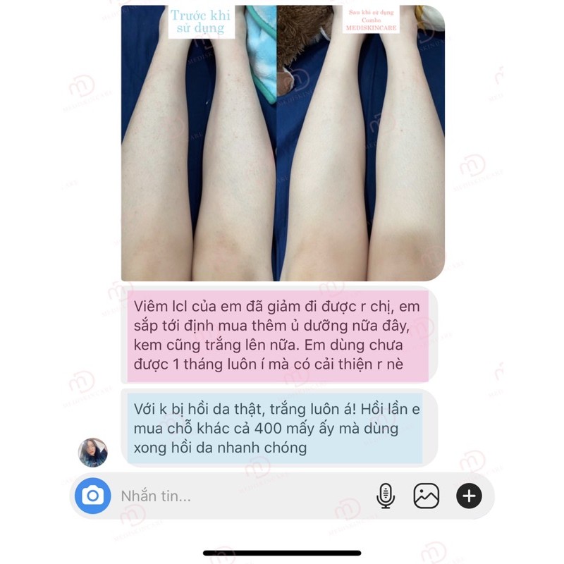 Body Mask Mediskincare | BigBuy360 - bigbuy360.vn