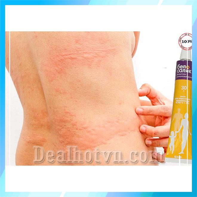 Kem bôi da cơ địa Belosalic Nga | BigBuy360 - bigbuy360.vn