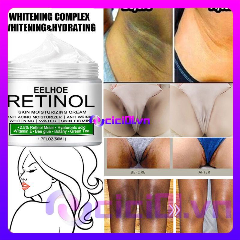 50G Eelhoe Trắng Da Tư Nhân Phần Dưỡng Trắng Tẩy Trắng Mặt Cơ Thể Làm Sáng Kem Sát Nách Đầu Gối