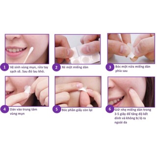 [Có sẵn] Miếng Dán Mụn Cosrx Acne Pimple Master Patch
