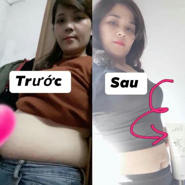 Tặng máy massage toàn thân Relax & tone khi mua 2 Kem tan mỡ Tslim body giảm ngay 5-10cm sau 1 tuyp sử dụng | BigBuy360 - bigbuy360.vn