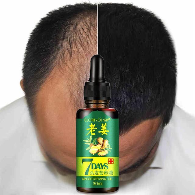 Serum mọc tóc, kích thích phát triển tóc, dưỡng tóc 7 ngày