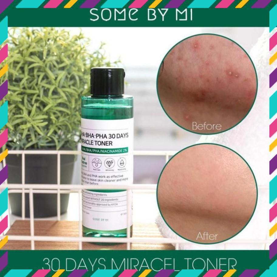 [FREESHIP]-Nước hoa hồng ngừa mụn kiềm dầu Some By Mi AHA-BHA-PHA 30 Days Miracle Toner 150ml Auth Hàn Quốc | BigBuy360 - bigbuy360.vn