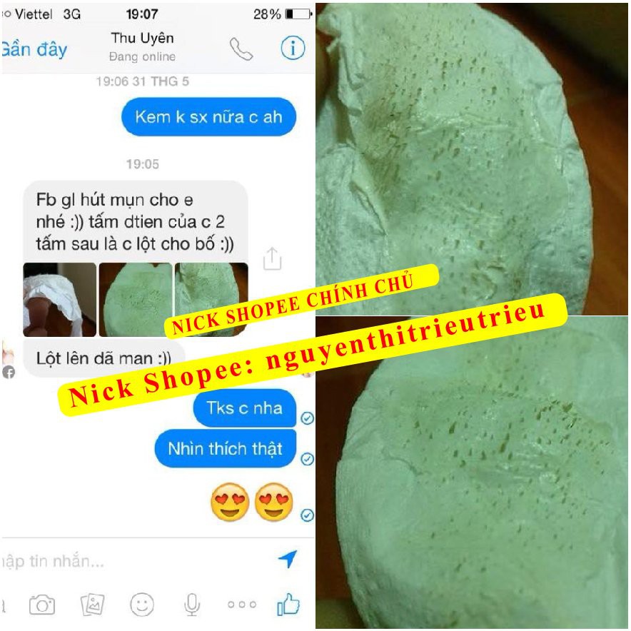 Gel Hút Mụn Bạc Hà,lột mụn cám, mụn đầu đen, da chết, lông tơ, bụi bẩn | BigBuy360 - bigbuy360.vn