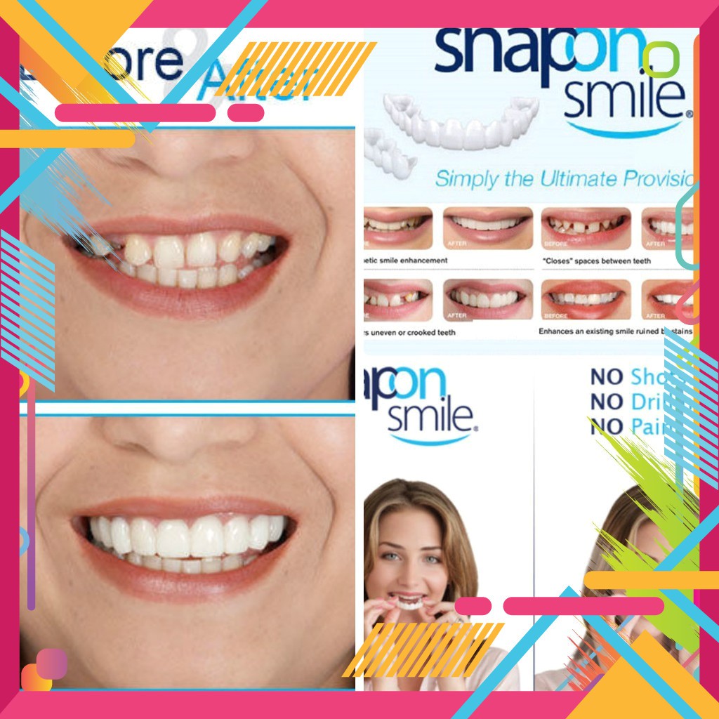 [GIÁ HỦY DIỆT] RĂNG GIẢ SNAP ON SMILE [HOT]