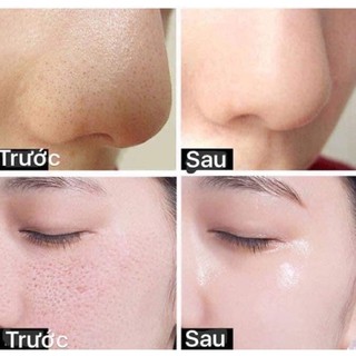 Serum se khít lỗ chân lông