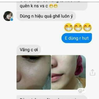 KEM FACE TRẮNG DA NGỪA MỤN HUYỀN PHI