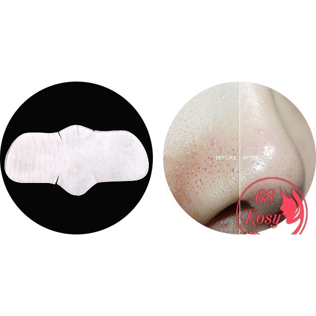 Miếng đẩy mụn Goodbye Blackhead hiệu quả (kèm que nặn và gạt)