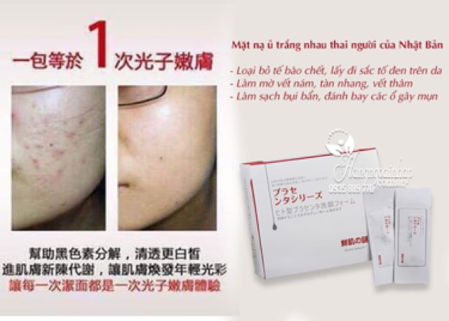 ⚡(KHÔNG TRẮNG KHÔNG LẤY TIỀN) ⚡Gói Ủ Trắng Face Nhau Thai Cừu Nội Địa Nhật, | BigBuy360 - bigbuy360.vn