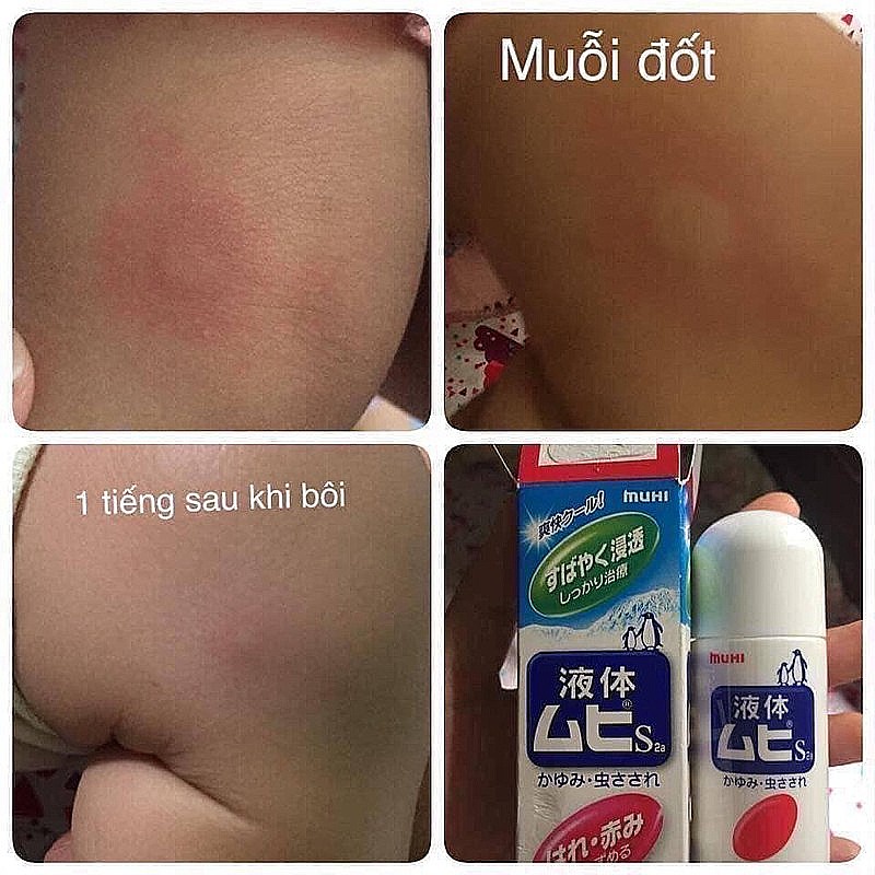 Lăn bôi muỗi đốt côn trùng đốt Muhi Nhật 50ml