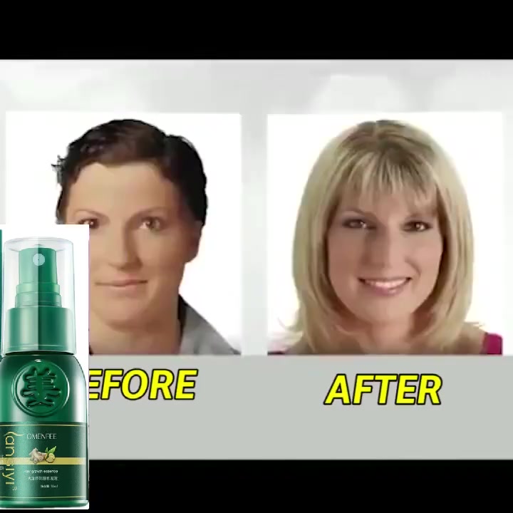 Tinh dầu mọc tóc nhanh,dau dưỡng tóc,serum mọc tóc,ngăn ngừa rụng tóc hair oil grow 30ml kích mọc tóc | BigBuy360 - bigbuy360.vn