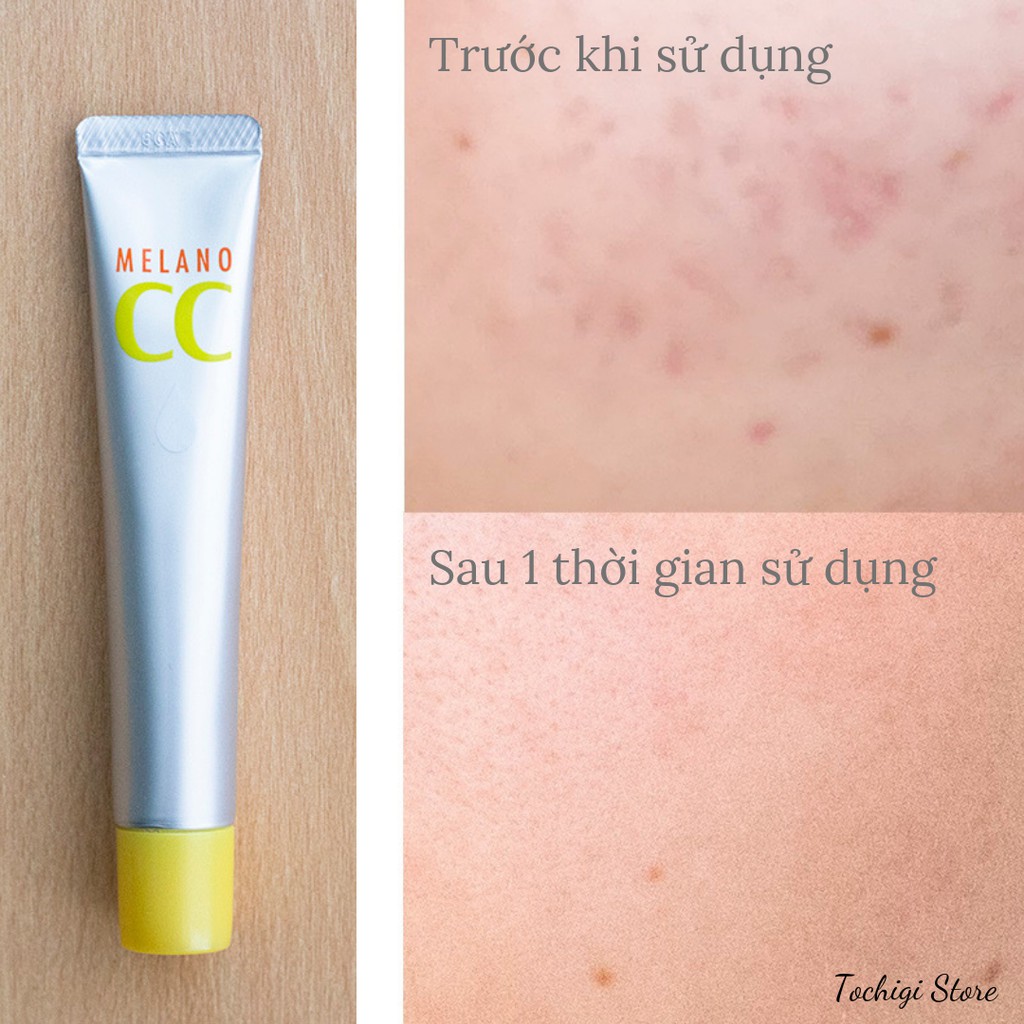 Serum Melano CC Vitamin C, E ngừa mụn và dưỡng trắng