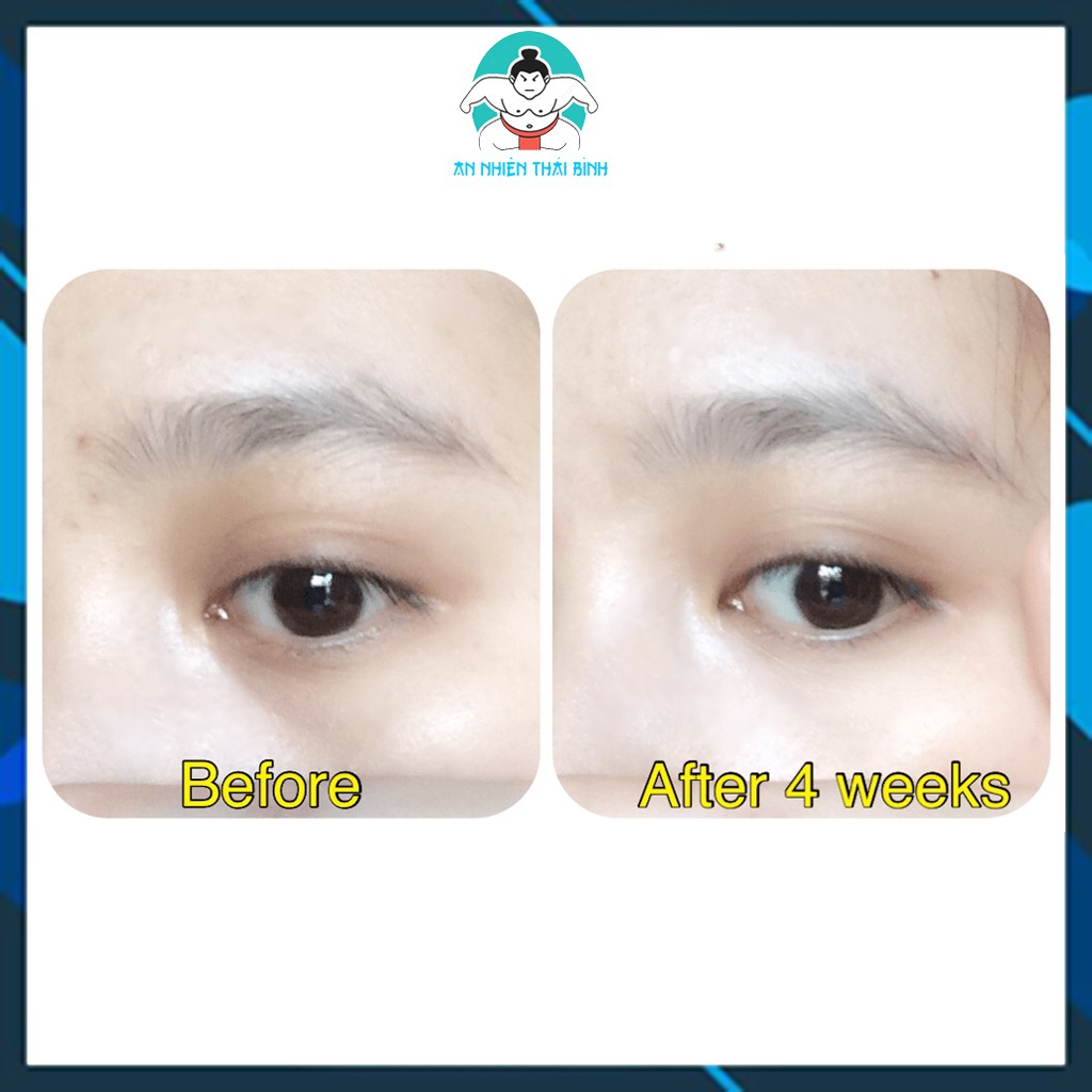 ⚡Chính hãng⚡ Kem dưỡng mắt Meishoku placenta medicated whitening eye cream nhật bản 30g | BigBuy360 - bigbuy360.vn