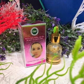 Serum Ngừa Mụn Thâm - Trắng Da Miền Thảo Mộc 30ml