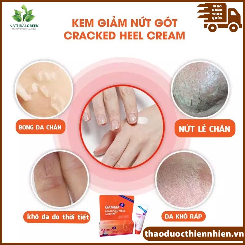 Gamma Cracked Heel Kem giảm nứt gót chân, khô nứt da