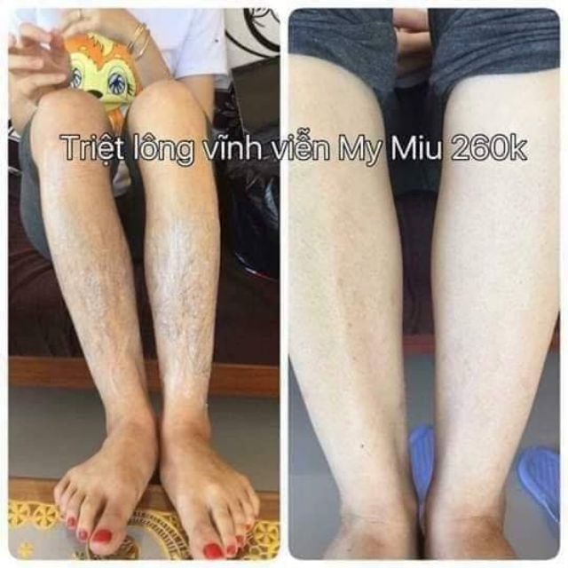 KEM TẨY LÔNG MY MIU