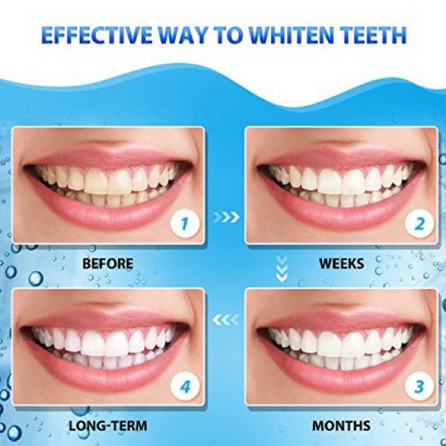 [1 HỘP] Dán trắng răng Crest 3D White