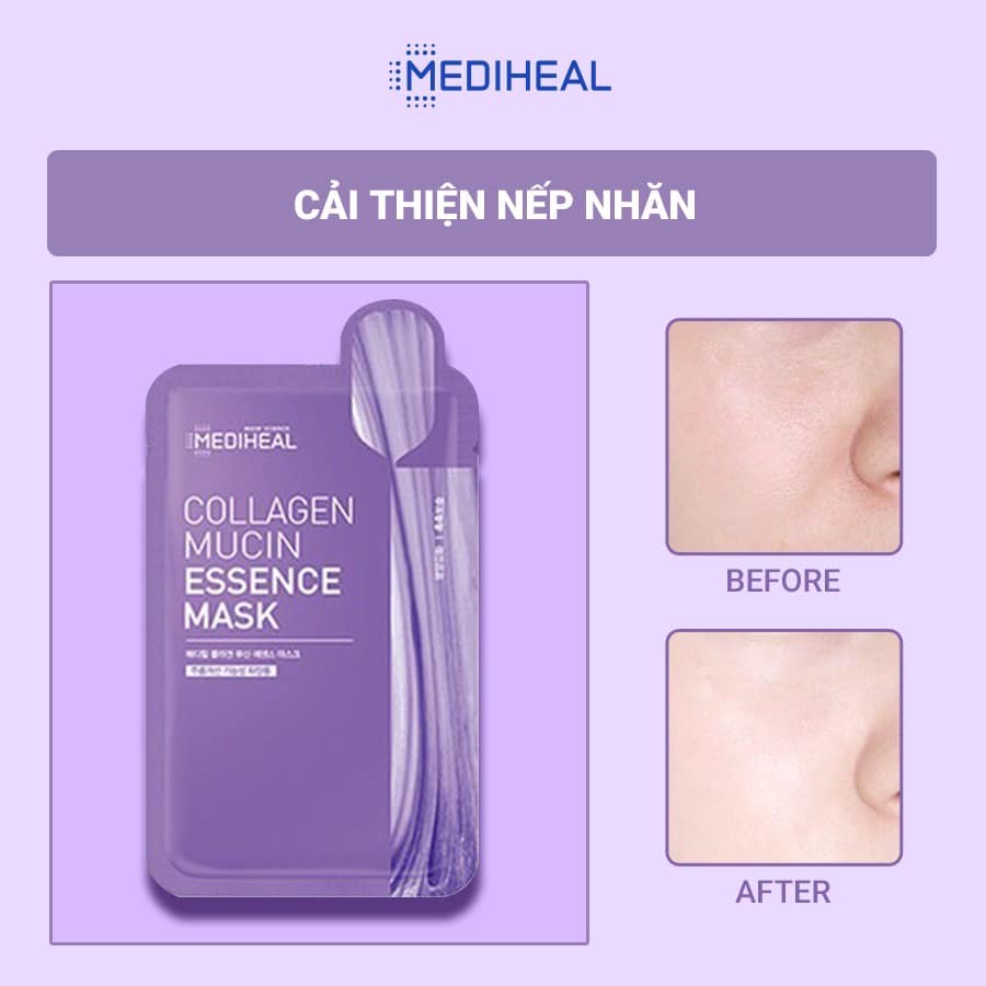 (MẪU MỚI) Mặt Nạ Dưỡng Da Mediheal Essential Mask EX  2021 sẵn hàng