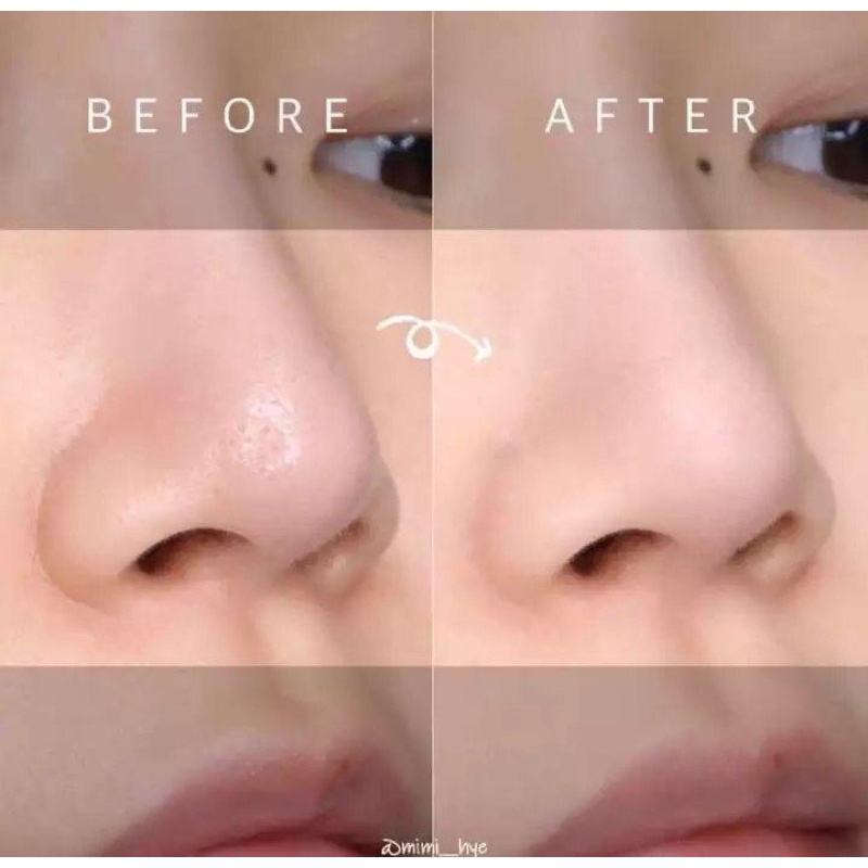 Red Peel Clear Stick So Natural Pore Blackhead &amp; Face Thanh Lăn Mụn Đầu Đen 23gram