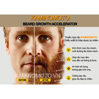 Serum mọc râu Kaminomoto Nhật Bản,💥HÀNG CAO CẤP CHÍNH HÃNG💥 giúp râu mọc nhanh, mọc rậm đẹp mạnh mẽ nam tính.