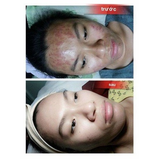 kem chamomile hồng sâm [ mẫu mới 2021 ]