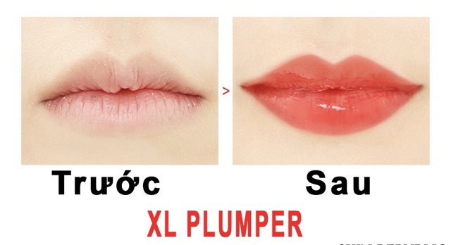 Son Dưỡng Trị Thâm Môi XL Plumper So Natural l Nhập Khẩu Chính Hãng Hàn Quốc