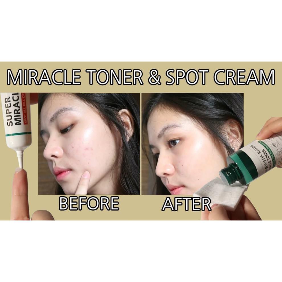 [Chính hãng] Kem Dưỡng Giảm Mụn SOME BY MI Super Miracle Spot All Kill Cream 30ml