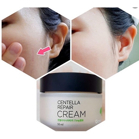 Kem Dưỡng Rau Má Goodndoc Centella Repair Cream Dưỡng Ẩm Phục Hồi Da 50ml - Khongcoson