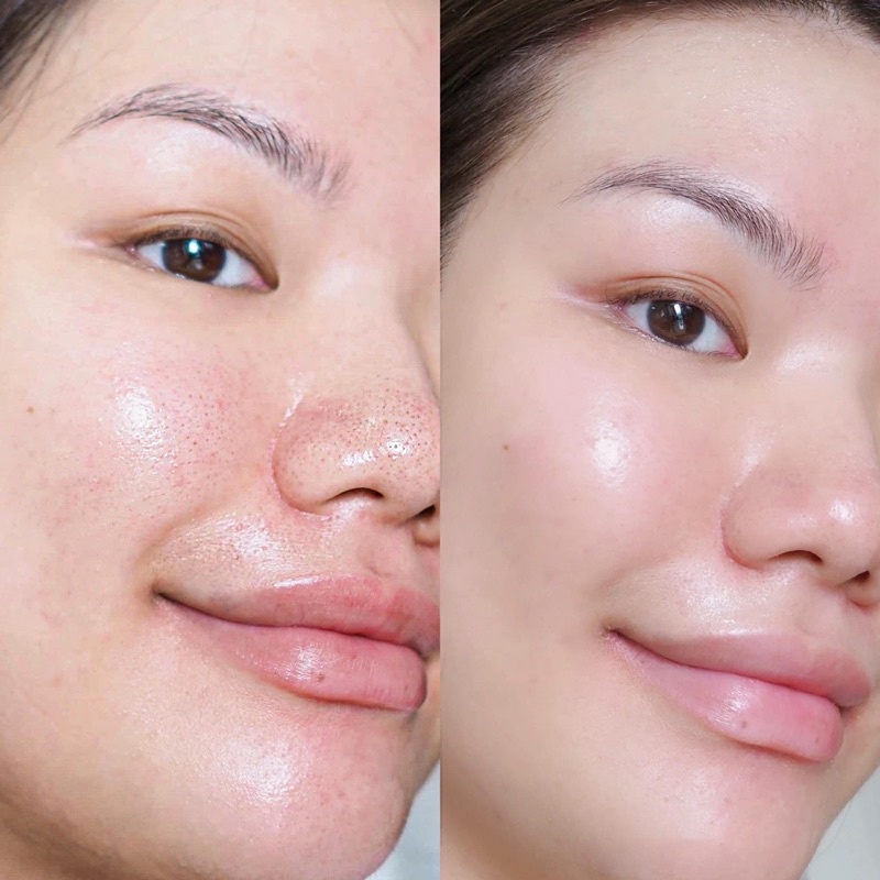 Mặt nạ đất sét vừa ngừa mụn vừa dưỡng trắng da Eclat du teint