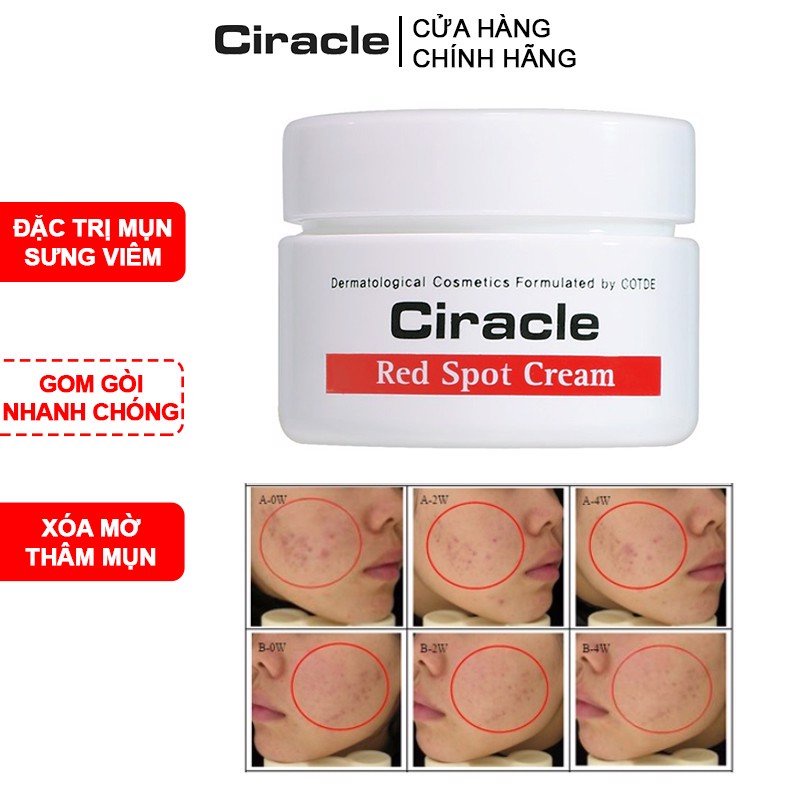{XẢ KHO SỈ} Kem Giảm Mụn Ciracle Red Spot Cream 30g