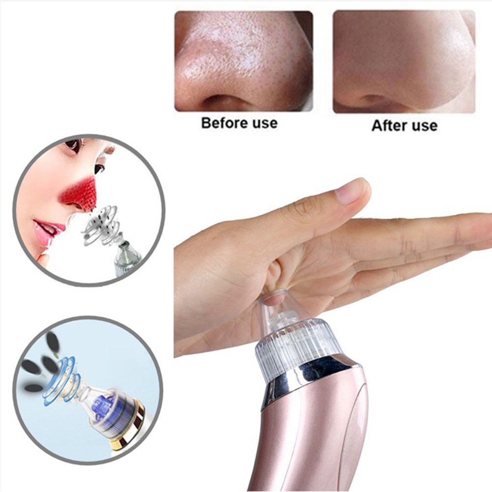 Máy Hút Mụn Đầu Đen Làm Sạch Lỗ Chân Lông Chăm Sóc Da Mặt