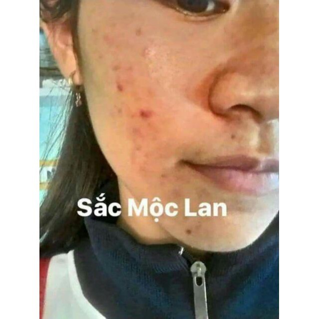 [MB01] Combo Sắc Mộc Lan