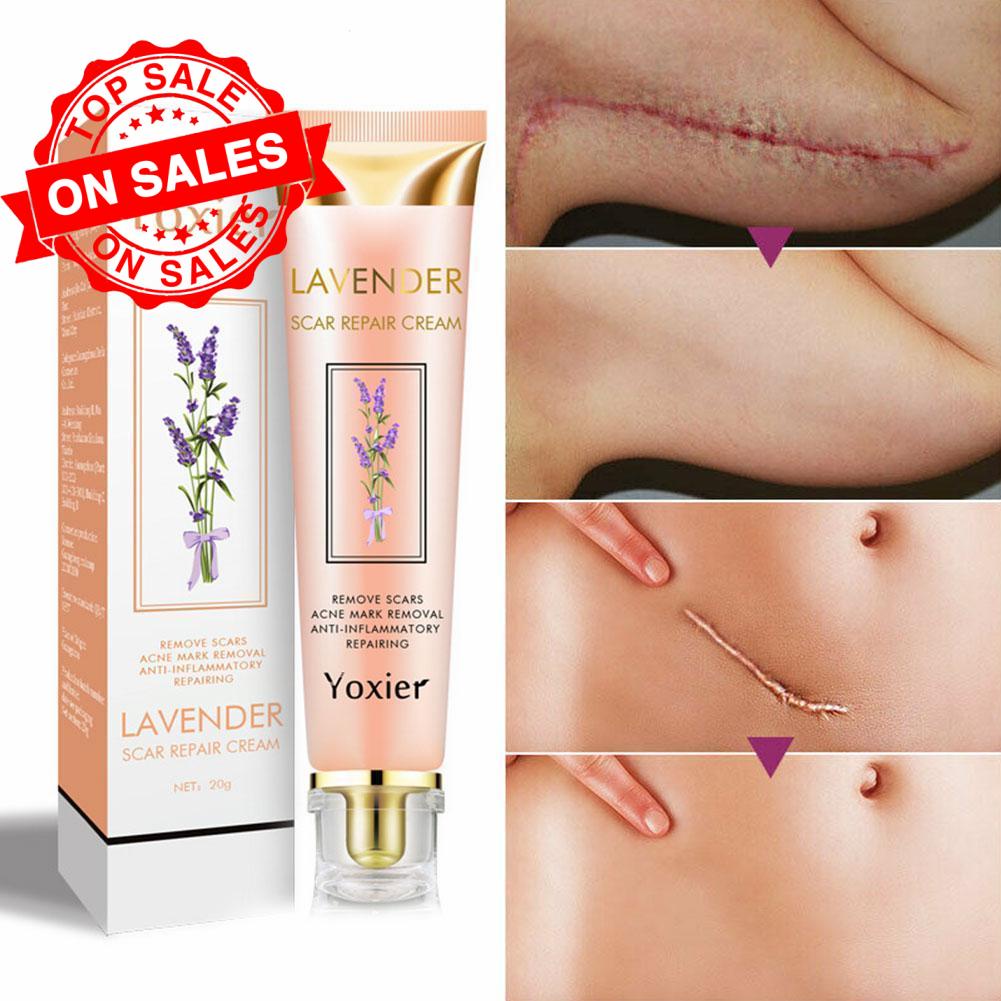 Kem cải thiện sẹo Yoxier C4B8 chiết xuất hoa oải hương giúp phục hồi và làm mịn da hiệu quả