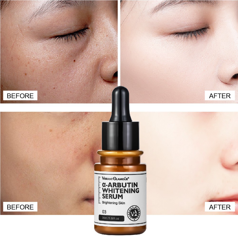 Tinh chất VIBRANT GLAMOUR α-Arbutin Niacinamide 10% làm trắng da/ mờ thâm/ mịn màng 30ml | BigBuy360 - bigbuy360.vn