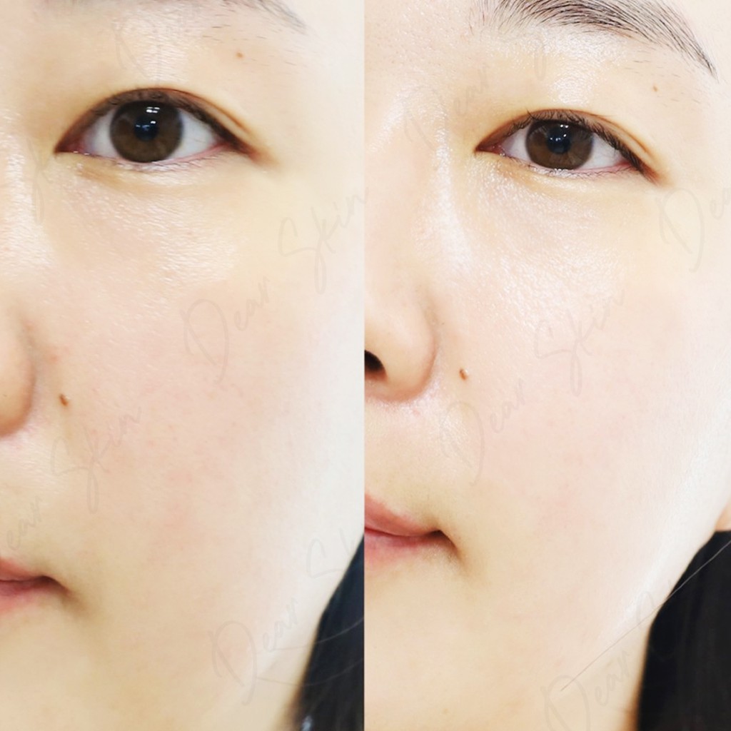 [Chính Hãng] Gel Dưỡng Ẩm ILLIYOON CERAMIDE ATO SOOTHING GEL 175 ML - Kem Dưỡng Ẩm Cho Mẹ và Bé | BigBuy360 - bigbuy360.vn