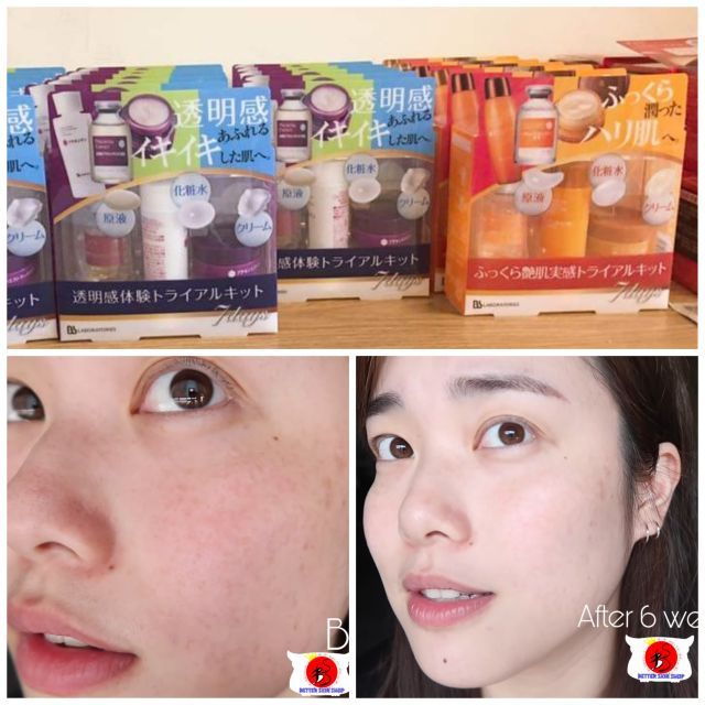 Bộ dưỡng trắng da chống lão hóa collagen và nhau thai BB Laboratories