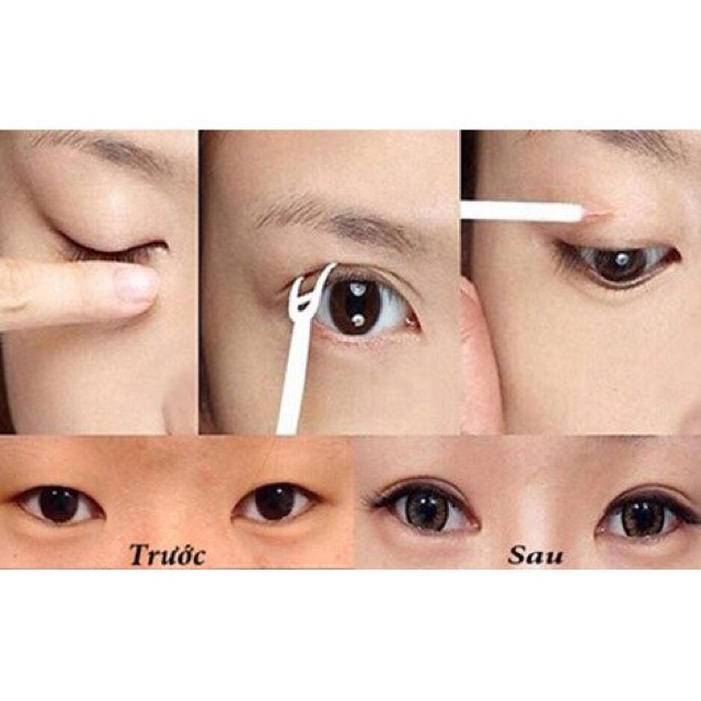 Hộp 240 chiếc kích mí lưới