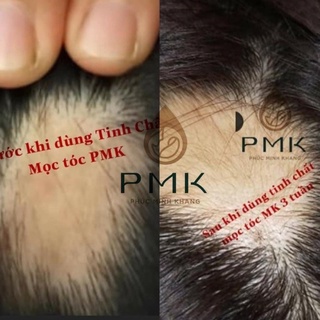 Tinh chất moc Tóc cao cấp Minh Khang