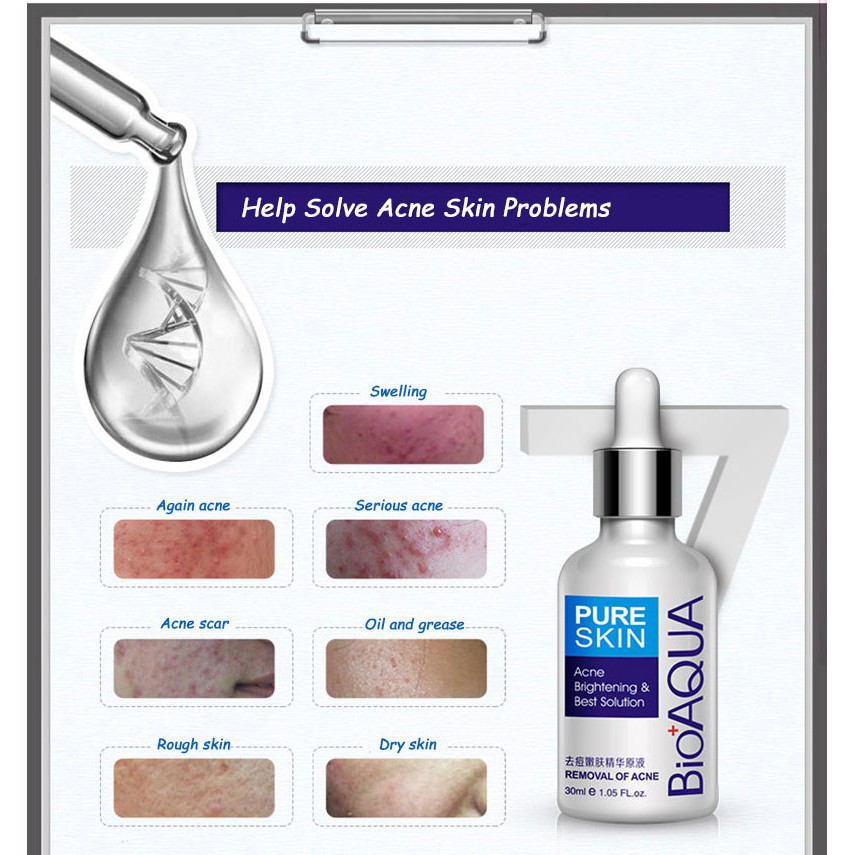 Tinh dầu Hỗ Trợ Giảm mụn dưỡng ẩm trắng da nhãn hiệu Bioaqua | BigBuy360 - bigbuy360.vn