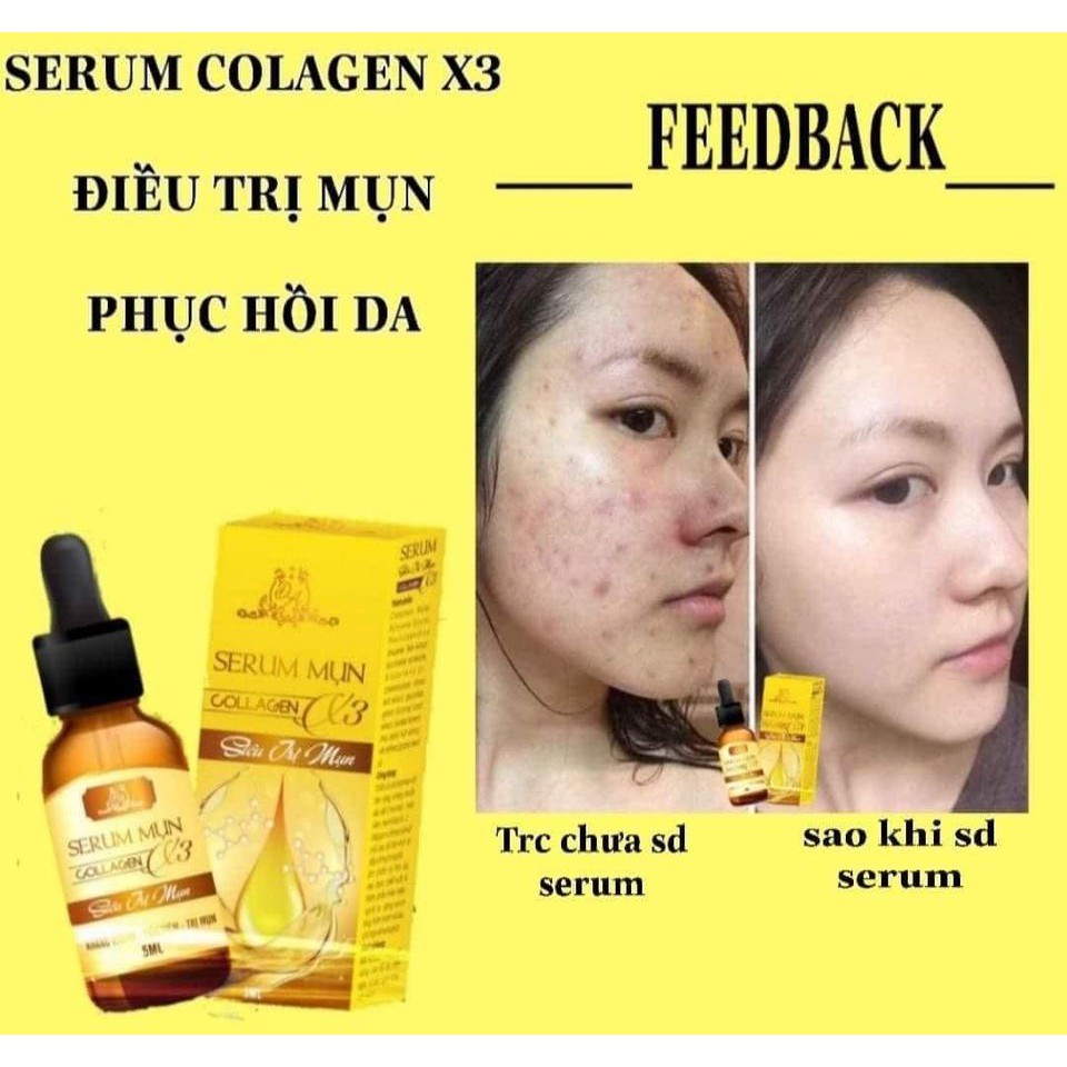 Serum Mụn Collagen X3 | BigBuy360 - bigbuy360.vn