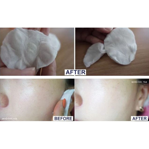 Nước Hoa Hồng Cân Bằng Độ Ẩm Evoluderm Lotion Tonique Peaux Sensibles | BigBuy360 - bigbuy360.vn