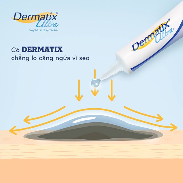 Kem hỗ trợ sẹo Dermatix Ultra 15g kem giảm sẹo lồi, sẹo phẫu thuật, sẹo thâm do mụn, rạn da