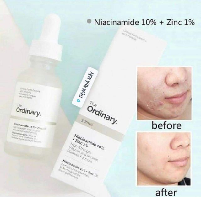 [Chính hãng 100%] Serum The Ordinary Niacinamide 10% + Zinc 1% 30ml - Serum chống viêm, giảm kích ứng dành cho da MỤN