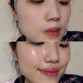 - Abib Mild Acidic pH Sheet Mask Heartleaf fit - Mặt na chuyên phục hồi sâu da nhạy cảm, tổn thương