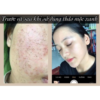Serum thảo mộc xanh 3 lọ