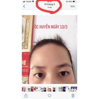 Tinh chất moc Tóc cao cấp Minh Khang
