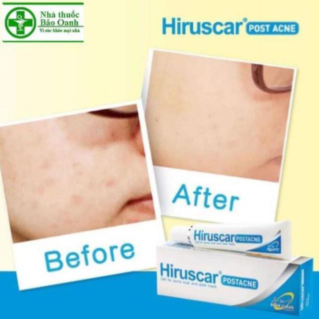 Gel Bôi Da Hiruscar Post Acne