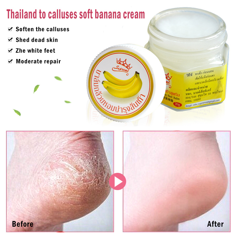 Beauty Anti-Drying Crack Cream Dead Skin Remover Banana Oil Repair Skin Care Product WIND