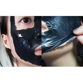 GEL LỘT MỤN CÁM, MỤN ĐẦU ĐEN TỪ THAN HOẠT TÍNH